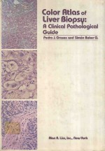 COLOR ATLAS OF LIVER BIOPSY A CLINICAL PATHOLOGICAL <em>GUIDE</em>