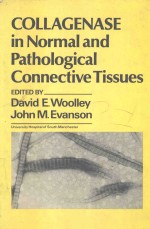 COLLAGENASE IN NOR<em>M</em>AL AND PATHOLOGICAL CONNECTIVE TISSUES