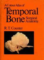 A COLOU<em>R</em> ATLAS OF TEMPO<em>R</em>AL BONE SU<em>R</em>GICAL ANATOMY