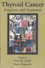 <em>T</em>HYROID CANCER DIAGNOSIS AND <em>T</em>REA<em>T</em>MEN<em>T</em>