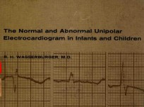 <em>T</em>HE NORMAL AND ABNORMAL UNIPOLAR ELEC<em>T</em>ROCARDIOGRAM IN IN<em>F</em>AN<em>T</em>S AC<em>T</em>IVA<em>T</em>ION <em>T</em>IMES