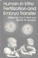 HUMAN IN VITRO FERTILIZATION AN<em>D</em> EMBRYO TRANSFER