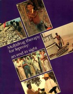 MULTIDRUG THERAPY FOR LEPROSY AN END <em>IN</em> SIGHT