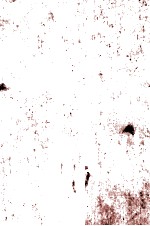 X-Rays and Radium in The Treatment of Diseases of The Skin Fourth <em>Edition</em>
