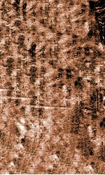 痘疹定论  <em>卷</em><em>3</em>-<em>4</em>