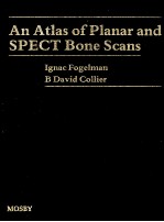 <em>AN</em> ATLAS OF PL<em>AN</em>AR <em><em>AN</em>D</em> SPECT BONE SC<em>AN</em>S