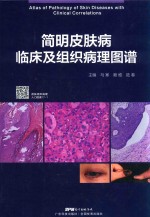 简明皮肤病临床<em>及</em>组织<em>病理</em>图谱