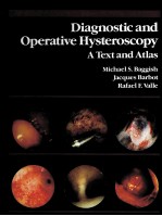 DI<em>A</em>GNOSTIC <em>A</em>ND OPER<em>A</em>TIVE HYSTEROSCOPY: <em>A</em> <em>TEXT</em> <em>A</em>ND <em>A</em>TL<em>A</em>S