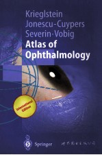 Atlas <em>of</em> Ophthalmology