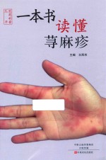 一本书读懂荨麻疹