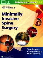 Minimally invasive spine <em>surgery</em>