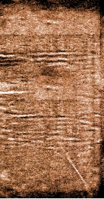 东垣十书  外科精义  下