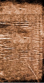 东垣十书  外科精义  上