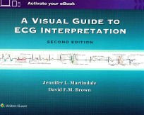 <e<em>m</em>>A</e<em>m</em>> VISU<e<em>m</em>>A</e<em>m</em>>L GUIDE TO ECG INTERPRET<e<em>m</em>>A</e<em>m</em>>TION SECOND EDITION
