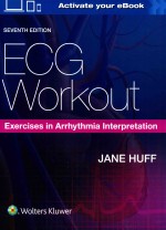 ECG WORKOUT <em>EXERCISES</em> IN ARRHYTHMIA <em>INTERPRETATION</em> SEVENTH EDITION