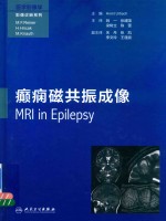 医学影像学影像诊断系列  癫痫<em>磁<em>共振</em></em>成像