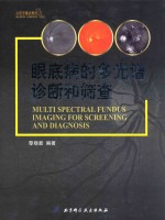 眼底病<em>的</em>多光谱诊断和筛查