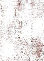 GASTROINTESTINAL DISEASE  PATHOPHYSIOLOGY DIAGNOSIS <em>MANAGEMENT</em>