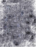 THE PR<em>IN</em>CIPLES AND ART <em>OF</em> PLASTIC SURGERY <em>VOLUME</em> 11