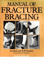 <em>manual</em> <em>of</em> fracture Bracing