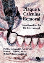 Plaque and calculus removal : considerations <em>for</em> <em>the</em> professional