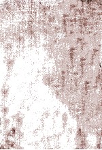 DIAGNOSIS <em>OF</em> SURGICAL DISEASE  <em>VOLUME</em> 1