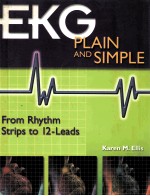 EKG Plain and Simple: <em>From</em> Rhythm Strips <em>to</em> 12-Leads