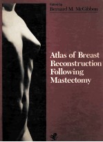 Atlas of breast reconstruction following <em>ma</em>stecto<em>my</em>