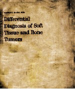 Differential diagnosis of soft tissue and bone tu<em>mo</em>rs