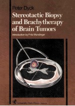 Stere<em>ot</em>actic bi<em>op</em>sy and brachytherapy <em>of</em> brain tum<em>or</em>s