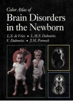 Color atlas of brain disor<em>de</em>rs in the newborn