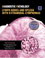 DIAGNOSTIC <em>PA</em>THOLOGY LYM<em>PH</em> NODES AND S<em>PL</em>EEN WITH EXTRANODAL LYM<em>PH</em>OMAS