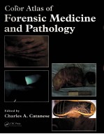COLOR ATLAS <em>OF</em> <em>FORENSIC</em> MEDICINE AND PATHOLOGY