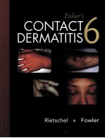 FISHER'S CONTACT <em>D</em>ERMATITIS 6