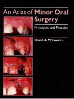AN ATLAS OF <em>MINOR</em> ORAL <em>SURGERY</em>