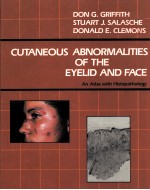 CUT<em>A</em>NEOUS <em>A</em>BNORM<em>A</em>LITIES OF THE EYELID <em>A</em>ND F<em>A</em>CE