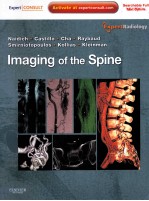 IMAGING OF THE S<em>P</em>INE EDITORS