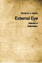 EXTERNAL EYE:<em>METHODS</em> <em>OF</em> EXAMINATION