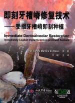 即刻<em>牙</em>槽嵴修复技术