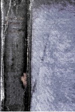 Su<em>r</em>gical Pathology