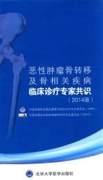 恶性肿瘤骨转移及骨相关疾病临床诊疗专家共识  2014版