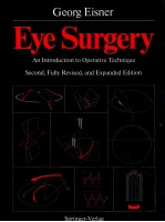 Eye <em>Surgery</em>