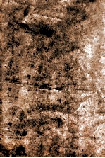 外科证治全生集  卷1-2