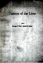 TUMORS OF THE LIVER