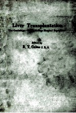 liver transplantation_<em>the</em> cambridge-king's college hospital experience